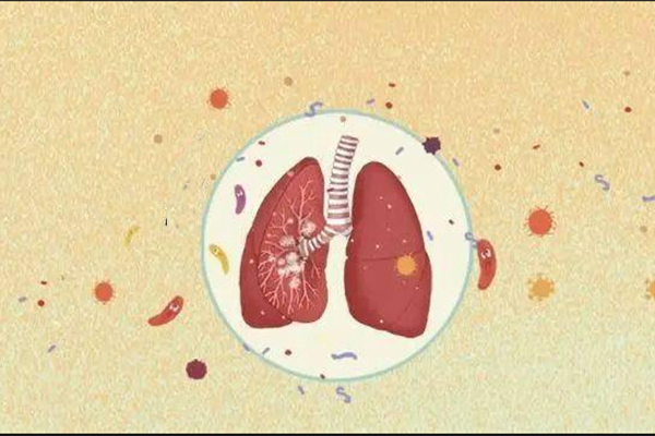 肺結(jié)核
