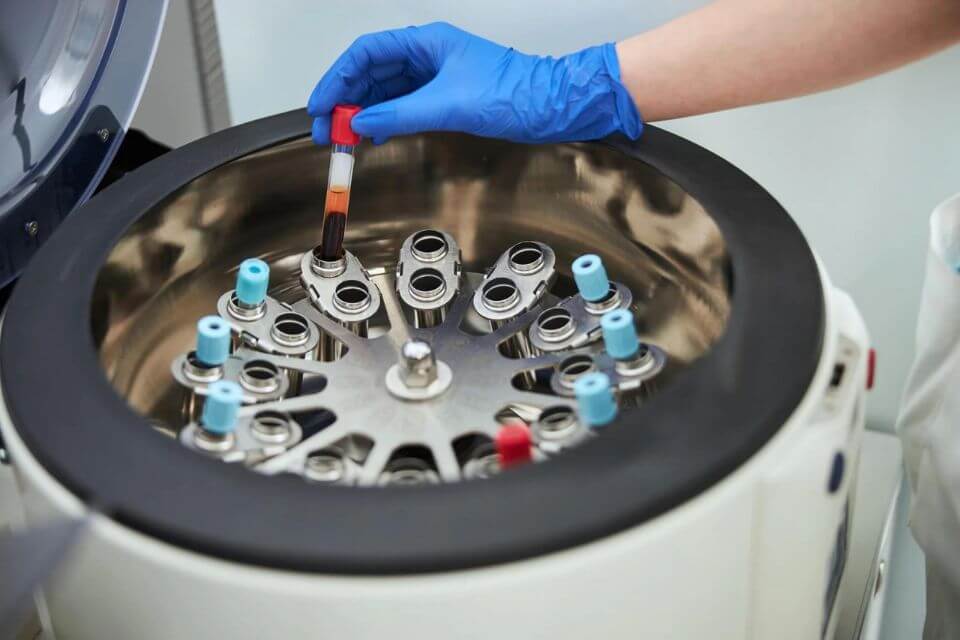 實驗員將裝有血液樣本的紅頂 VTM 管放入固定角度的鋁制轉(zhuǎn)子中