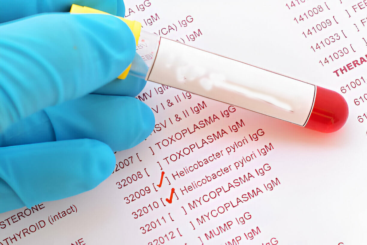 Blood sample with requisition form for Helicobacter pylori test