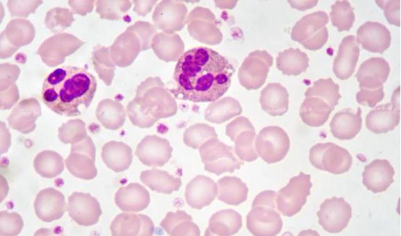 外周血白細(xì)胞