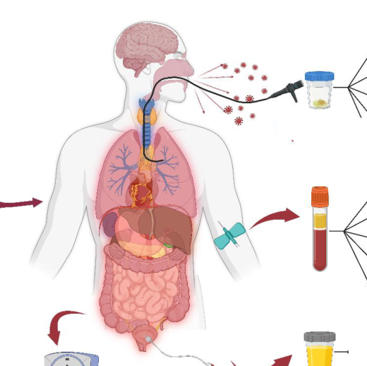 軍團菌肺炎的流行病特征、危險因素及其檢測方法